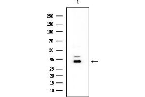 Western blot analysis of lysates from EC304 cells, using ANP32E Mouse Monoclonal Antibody at 1/1000 dilution.