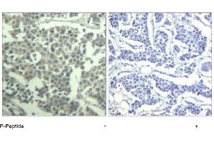 Image no. 1 for anti-Mast/stem Cell Growth Factor Receptor (KIT) (pTyr936) antibody (ABIN319288) (KIT anticorps  (pTyr936))