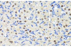 Immunohistochemistry of paraffin-embedded Rat ovary using TRIM27 Polyclonal Antibody at dilution of 1:100 (40x lens).