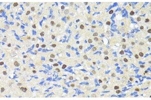 Immunohistochemistry of paraffin-embedded Rat ovary using TRIM27 Polyclonal Antibody at dilution of 1:100 (40x lens). (TRIM27 anticorps)