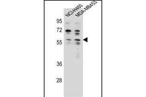 ANKRD34C Antibody (C-term) (ABIN655772 and ABIN2845210) western blot analysis in NCI-,MDA-M cell line lysates (35 μg/lane). (ANKRD34C anticorps  (C-Term))