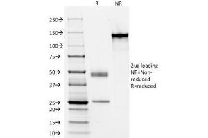 SDS-PAGE Analysis of Purified, BSA-Free Acidic Cytokeratin Antibody (clone AE1). (Keratin Acidic (AE1) anticorps)