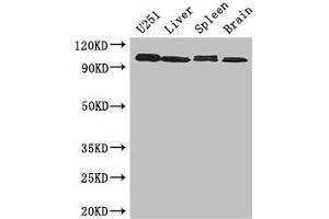 Western Blot Positive WB detected in: U251 whole cell lysate, Mouse liver tissue, Mouse Spleen tissue, Mouse brain tissue All lanes: MAP10 antibody at 3 μg/mL Secondary Goat polyclonal to rabbit IgG at 1/50000 dilution Predicted band size: 101 kDa Observed band size: 101 kDa (MAP1 anticorps  (AA 401-600))