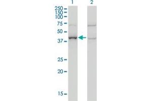 Western Blot analysis of ARMC8 expression in transfected 293T cell line by ARMC8 monoclonal antibody (M01), clone 2D9. (ARMC8 anticorps  (AA 287-385))