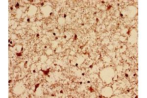 Immunohistochemistry analysis of human brain tissue using ABIN7150829 at dilution of 1:100 (Dynamin 1-Like anticorps  (AA 496-710))