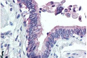 Lung, respiratory epithelium (CLIC4 anticorps  (N-Term))