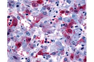 Anti-PTGFR antibody IHC of human adrenal, pheochromocytes.