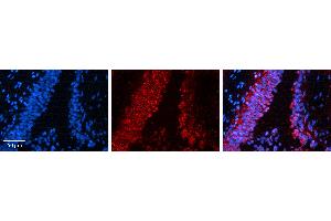 Rabbit Anti-SNAI1 Antibody   Formalin Fixed Paraffin Embedded Tissue: Human Urinary Bladder Tissue Observed Staining: Cytoplasm Primary Antibody Concentration: 1:100 Other Working Concentrations: N/A Secondary Antibody: Donkey anti-Rabbit-Cy3 Secondary Antibody Concentration: 1:200 Magnification: 20X Exposure Time: 0.