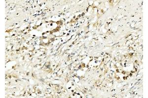 IHC analysis of PDCD4 using anti-PDCD4 antibody (ABIN5518943). (PDCD4 anticorps  (AA 346-446))