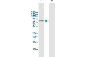 Western Blot analysis of ALDH3A2 expression in transfected 293T cell line by ALDH3A2 MaxPab polyclonal antibody.