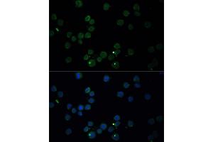 Immunofluorescence analysis of THP-1 cells using CHAT antibody (ABIN6131569, ABIN6138488, ABIN6138490 and ABIN6217173) at dilution of 1:100.