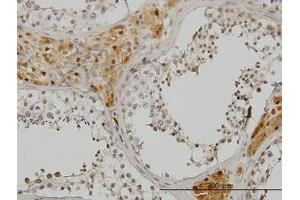 Image no. 1 for anti-CAMP Responsive Element Binding Protein 3 (CREB3) (AA 273-372) antibody (ABIN599141) (CREB3 anticorps  (AA 273-372))