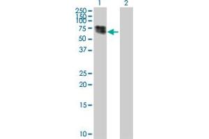 Lane 1: CTNS transfected lysate ( 44. (CTNS 293T Cell Transient Overexpression Lysate(Denatured))