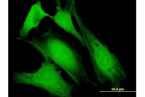 Immunofluorescence of purified MaxPab antibody to DBC1 on HeLa cell.
