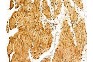 ABIN7094334 and ABIN7098381 at 1/100 staining Rat stomach tissue by IHC-P. (LARS2 anticorps  (Internal Region))