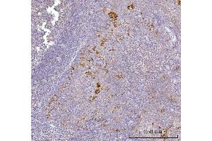 IHC analysis of AGPS using anti-AGPS antibody (ABIN7600146). (AGPS anticorps  (AA 154-658))