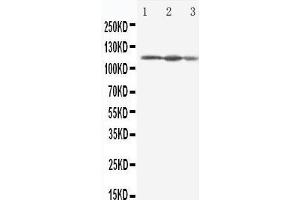 Anti-Eif3b antibody, Western blotting Lane 1: HELA Cell Lysate Lane 2: 293T Cell Lysate Lane 3: A431 Cell Lysate (EIF3B anticorps  (C-Term))
