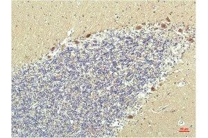 Immunohistochemical analysis of paraffin-embedded Human Brain Tissue using PPAR Delta Mouse mAb diluted at 1:200.