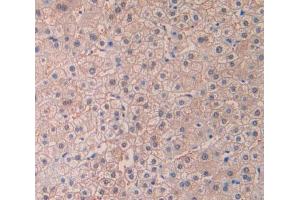 Used in DAB staining on fromalin fixed paraffin- embedded liver tissue