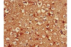 Immunohistochemistry of paraffin-embedded human brain tissue using ABIN7153847 at dilution of 1:100