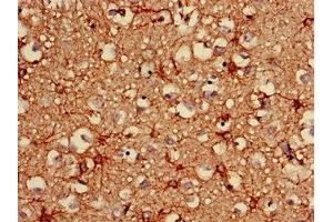 Immunohistochemistry of paraffin-embedded human brain tissue using ABIN7153847 at dilution of 1:100 (GFAP anticorps  (AA 292-432))