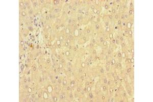 Immunohistochemistry of paraffin-embedded human liver tissue using ABIN7149462 at dilution of 1:100 (GLCE anticorps  (AA 29-617))