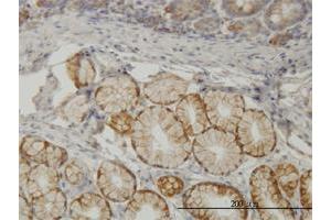 Immunoperoxidase of monoclonal antibody to TLN1 on formalin-fixed paraffin-embedded human small Intestine. (TLN1 anticorps  (AA 1052-1149))