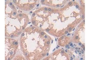 Detection of IL10 in Human Kidney Tissue using Polyclonal Antibody to Interleukin 10 (IL10) (IL-10 anticorps  (AA 19-178))