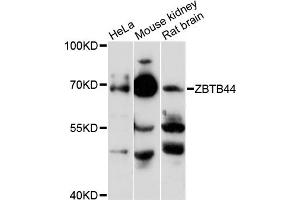 Western blot analysis of extracts of various cell lines, using ZBTB44 antibody (ABIN6291829) at 1:3000 dilution. (ZBTB44 anticorps)