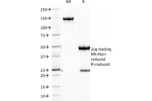 SDS-PAGE Analysis Purified CDH16 Mouse Monoclonal Antibody (CDH16/2125) (unconjugated). (Cadherin-16 anticorps  (AA 371-507) (Biotin))