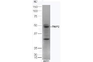 Human A431 lysates probed with Rabbit Anti-TNIP2 Polyclonal Antibody, Unconjugated  at 1:5000 for 90 min at 37˚C. (TNIP2 anticorps  (AA 85-180))