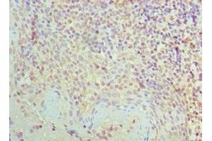 Immunohistochemistry of paraffin-embedded human tonsil tissue using ABIN7170857 at dilution of 1:100 (SMC1A anticorps  (AA 1-130))