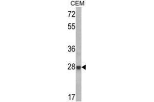 Western blot analysis of IGFBP6 Antibody (C-term) in CEM cell line lysates (35ug/lane). (IGFBP6 anticorps  (C-Term))