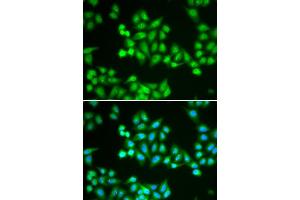 Immunofluorescence (IF) image for anti-Chromodomain Helicase DNA Binding Protein 2 (CHD2) antibody (ABIN1980262) (CHD2 anticorps)