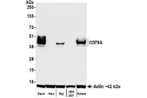 Western Blotting (WB) image for anti-B-cell antigen receptor complex-associated protein alpha chain (CD79A) (AA 176-226) antibody (ABIN7454005) (Recombinant CD79a anticorps  (AA 176-226))