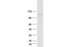 Validation with Western Blot