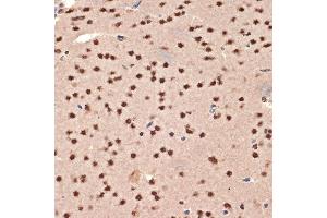Immunohistochemistry of paraffin-embedded mouse brain using CIRBP Rabbit mAb (ABIN7266452) at dilution of 1:100 (40x lens).