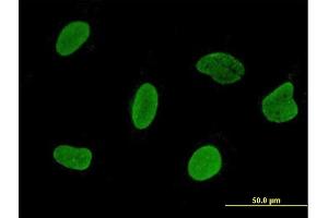 Immunofluorescence of monoclonal antibody to C15orf15 on HeLa cell. (RSL24D1 anticorps  (AA 1-150))