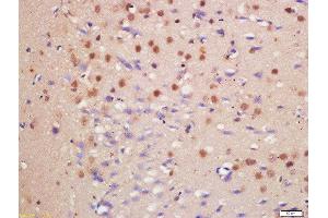 Formalin-fixed and paraffin embedded rat brain labeled with Anti-HDAC3/HD3 Polyclonal Antibody, Unconjugated  at 1:200 followed by conjugation to the secondary antibody and DAB staining