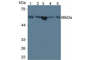 Figure. (LPCAT3 anticorps  (AA 122-233))