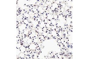 Immunohistochemistry of paraffin embedded mouse lung using UBE3A (ABIN7076105) at dilution of 1:500 (400x lens)