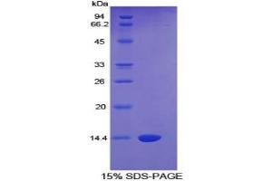 SDS-PAGE of Protein Standard from the Kit (Highly purified E. (CTGF Kit CLIA)