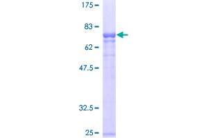 Image no. 1 for serpin Peptidase Inhibitor, Clade A (Alpha-1 Antiproteinase, Antitrypsin), Member 1 (SERPINA1) (AA 1-418) protein (GST tag) (ABIN1319584)