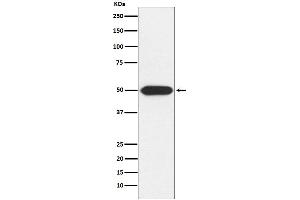 Western blot analysis of Protein Kinase A regulatory subunit I alpha expression in U-87MG cell lysate.