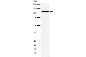 Western blot analysis of CD30 expression in A431 cell lysate.