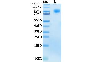 Human M-CSF R Tris-Bis PAGE under reduced condition.