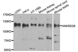 Western blot analysis of extracts of various cell lines, using ANKRD28 antibody. (ANKRD28 anticorps  (AA 1-300))