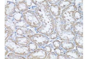 Immunohistochemistry of paraffin-embedded rat kidney using SNAI1 antibody.