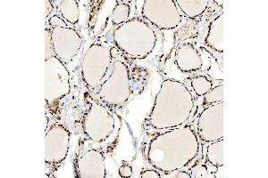 IHC analysis of SNF2H/SMARCA5 using anti-SNF2H/SMARCA5 antibody (ABIN7602001).