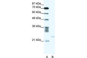 Western Blotting (WB) image for anti-BCL2-Related Protein A1 (BCL2A1) antibody (ABIN2463721) (BCL2A1 anticorps)